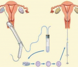 35岁女性备孕请做好以下检查，“健康沈阳代生宝宝”跑不远